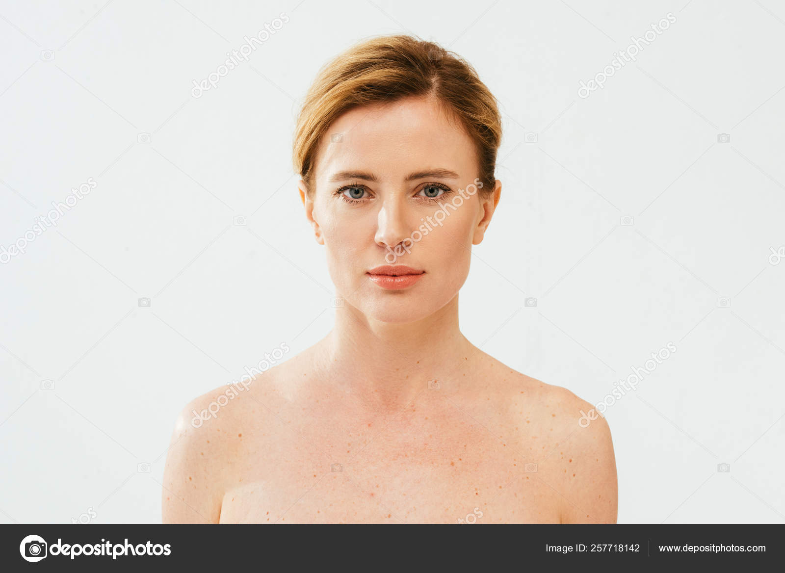 Naked Sick Woman Skin Illness Looking Camera White Stock Photo By