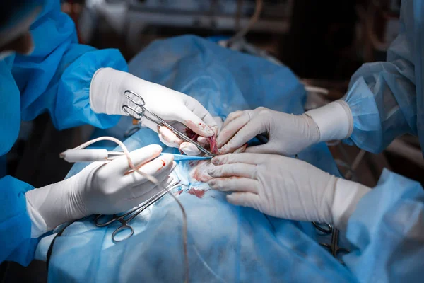 特写镜头外科医生的手在位血淋淋的白色手套做手术 — 图库照片