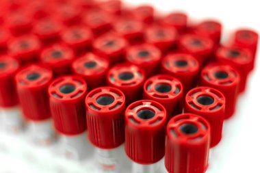 Steril vakum test-tüpler kan örneği için closeup seti