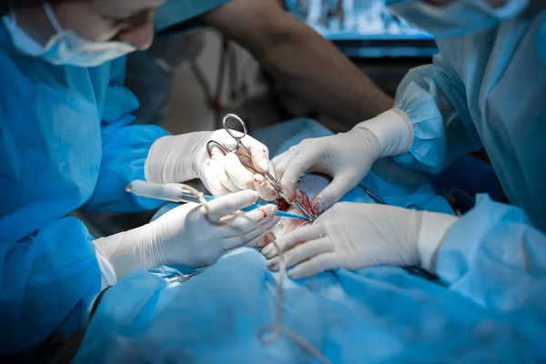 Las manos del cirujano de cerca en guantes blancos sangrientos hacen la operación —  Fotos de Stock