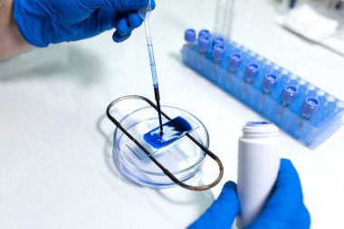 bilim adamı kan örneği için araştırma mikroskobu hazırlayın. Placi