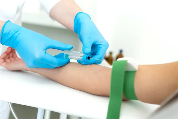 Eldivenli hemşire hastanın kolundaki damara bir iğne yerleştirir ve vakum kabına kan çeker. Kan örnekleme işlemi.