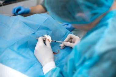 Profesyonel bir göz doktoru mikroskopla göz ameliyatı yapar. Doktor genişleticiyi gözüne soktu, enfeksiyonu yıkayıp şırıngayla çıkardı. Endoskopik göz ameliyatı. tıbbi ekipman.