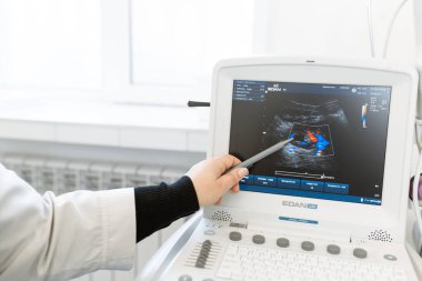 Doktor, hastanın Dnipro / Ukrayna 'ya özel ilgi göstermesi gereken sorunu ultrason makinesinin monitöründe bir kalemle gösterir - 04.27.2019