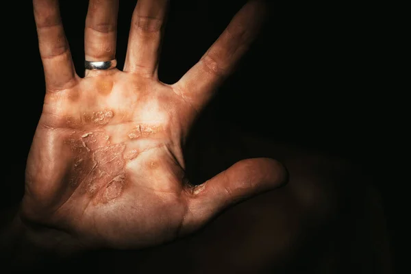 Donkere Hand Van Een Arbeider Met Eelt Protesten Stop — Stockfoto