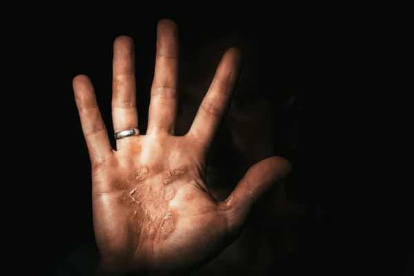 Donkere Hand Van Een Arbeider Met Eelt Protesten Stop — Stockfoto