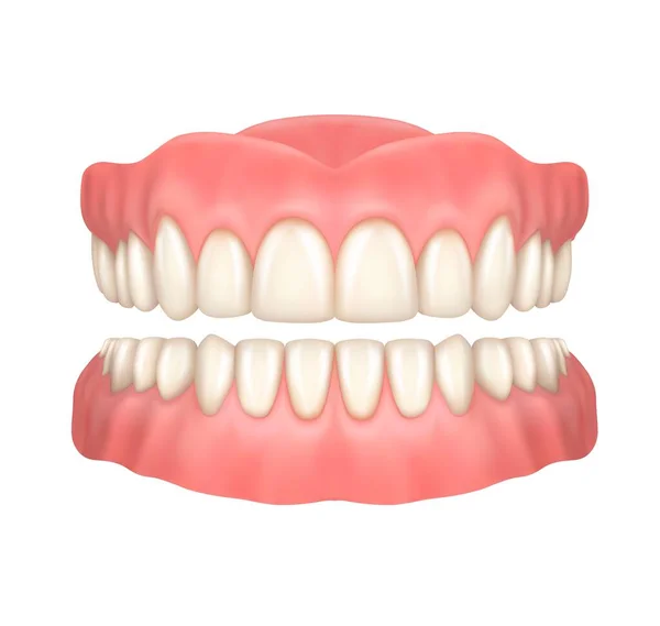 Dentures False Teeth Realistic Vector Design Orthodontics Aesthetic Dentistry Medicine — Stock Vector