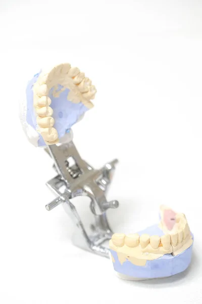 Sada Umělých Zubů — Stock fotografie
