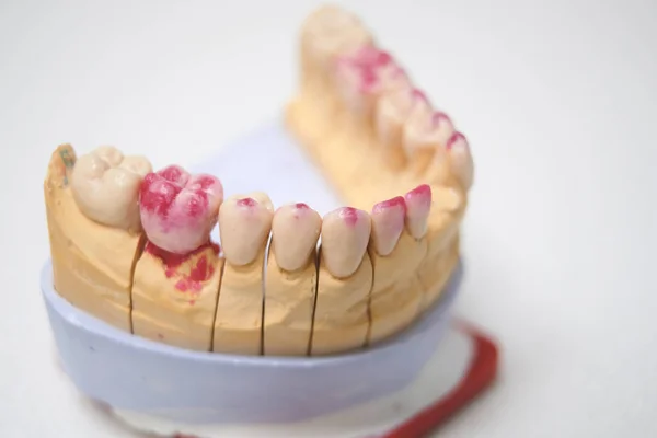 Conjunto Dos Dentes Falsos — Fotografia de Stock