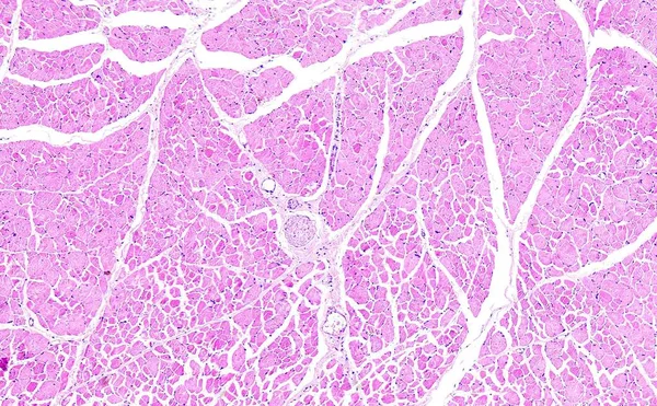 Histologia do tecido humano, mostrar necrose do músculo esquelético como visto ao microscópio, zoom 10x — Fotografia de Stock