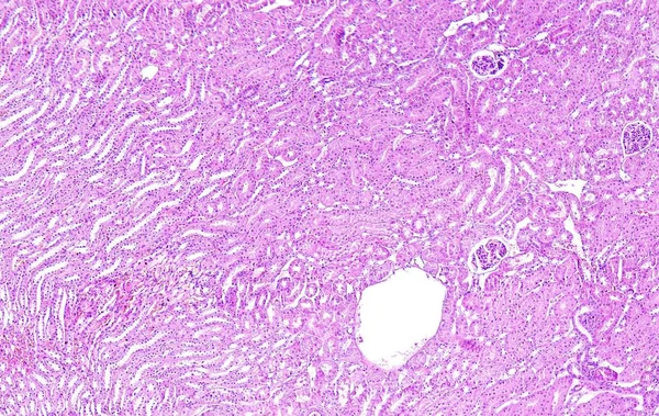 ショー腎臓組織 10 倍ズーム顕微鏡の下で見られるように人間ティッシュの組織学 — ストック写真