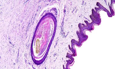 Histology of human tissue, show skin with hair follicles as seen under the microscope, 10x zoom clipart