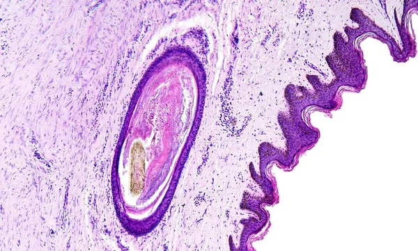 组织学的人体组织，显示皮肤与毛囊，在显微镜下观察，10 倍变焦 — 图库照片