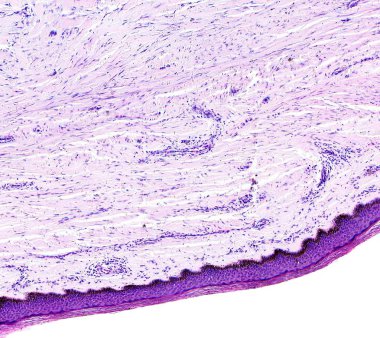 Histology of human tissue, show skin as seen under the microscope, 10x zoom clipart