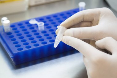 laboratuvarda DNA örnekleri ile eppendorf tüp tutan beyaz eldiven bilim adamı elleri.