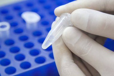 laboratuvarda DNA örnekleri ile eppendorf tüp tutan beyaz eldiven bilim adamı elleri.