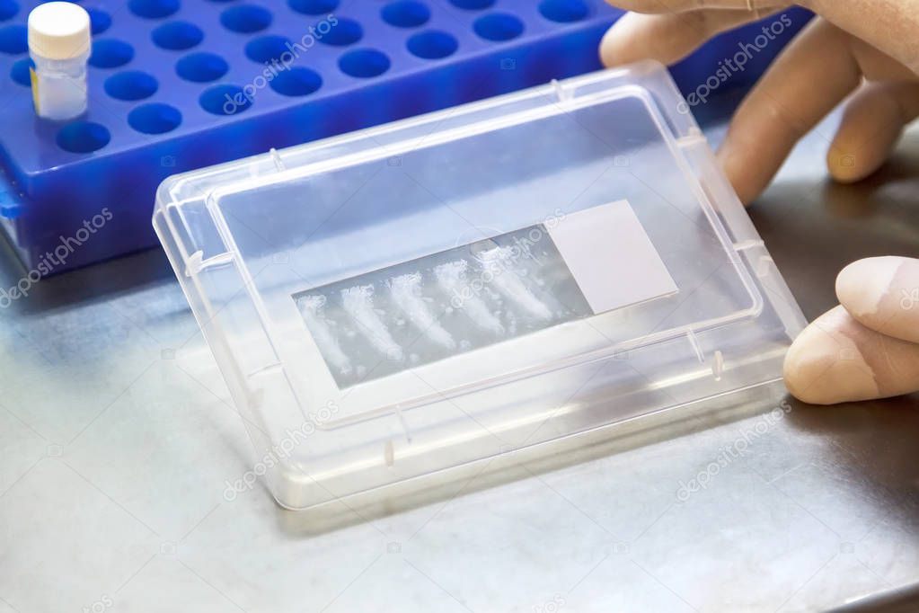 hands of a scientist in white gloves holding a slide with paraffin slices containing samples of human DNA in the laboratory