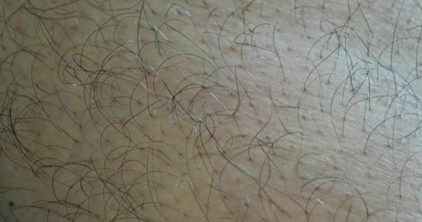 Uzun siyah saçlı epilasyon öncesi kıllı cilt. Makro çekimi. — Stok video