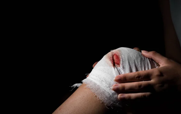 Joelho Ferido Com Gaze Branca Sangrenta Bandagem Fundo Preto Escuro — Fotografia de Stock