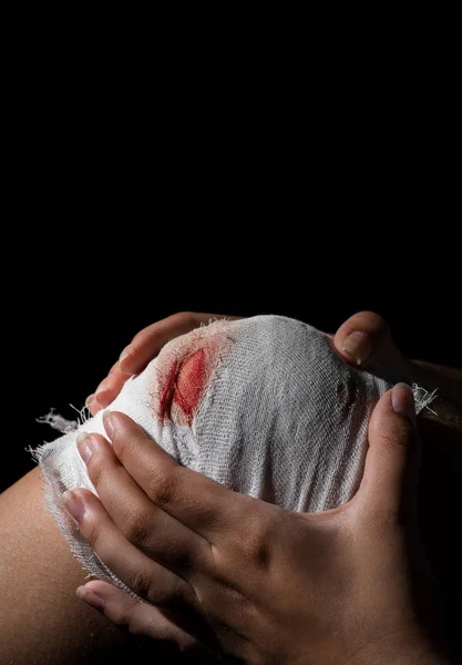 Rodilla Lesionada Con Vendaje Gasa Sangrienta Blanca Sobre Fondo Negro — Foto de Stock