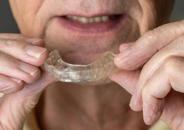 Senior legt Nachtwächter auf schiefe Zähne — Stockfoto