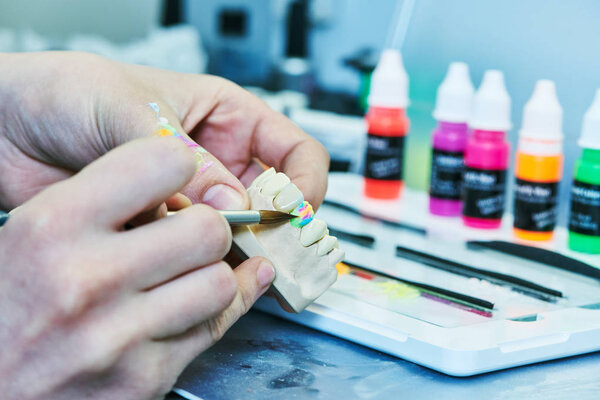 dental technician work. prosthesis production. teeth prototype construction