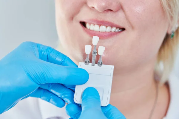 Dentistry. matching colour of the tooth enamel with whitening chart — Stock Photo, Image