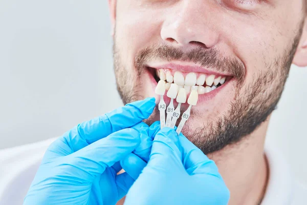 Zahnmedizin. passende Farbe des Zahnschmelzes mit Bleaching-Diagramm — Stockfoto