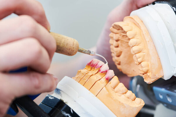 dental technician or prosthesis work. prosthetic dentistry process