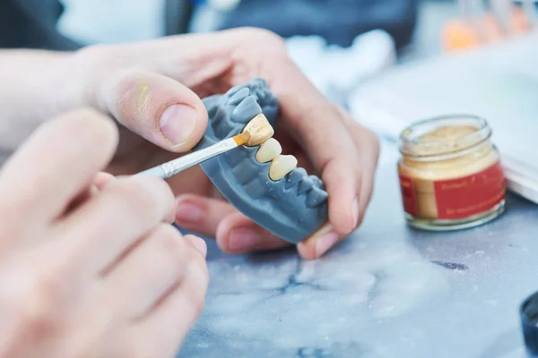歯科技術者の仕事だ。プロテーゼ制作です。歯の試作品製作 — ストック写真