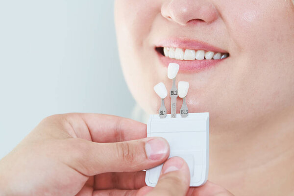 dentistry. matching colour of the tooth enamel with whitening chart
