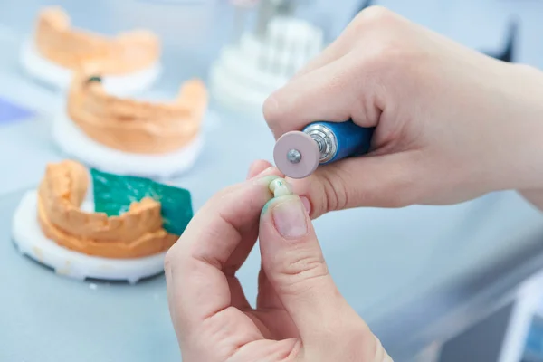 Técnico dentário ou trabalhador de prótese. processo de prótese dentária — Fotografia de Stock