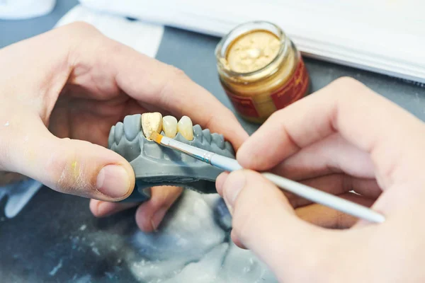 Lavoro di protesi dentarie. Pittura dei denti — Foto Stock