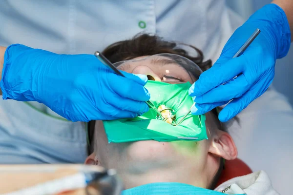 Cura e trattamento dei denti. lavoro dentista — Foto Stock