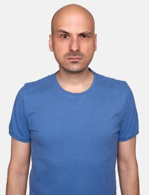 huysuz bir adam portresi. Gri arka plan üzerinde izole kızgın kel adam