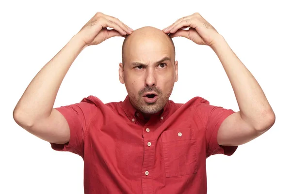 Calvo Gracioso Sorprendió Concepto Pérdida Cabello Hombre Aislado Sobre Fondo — Foto de Stock