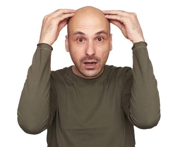 Shocked Bald Man Isolated White Studio Background Hair Loss — Stock Photo, Image