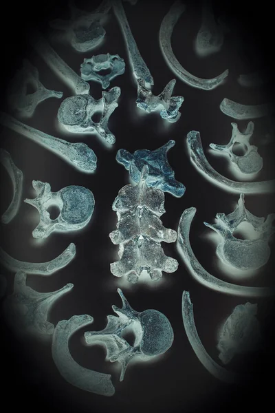 Alte menschliche Knochen, Rippen und Wirbel — Stockfoto