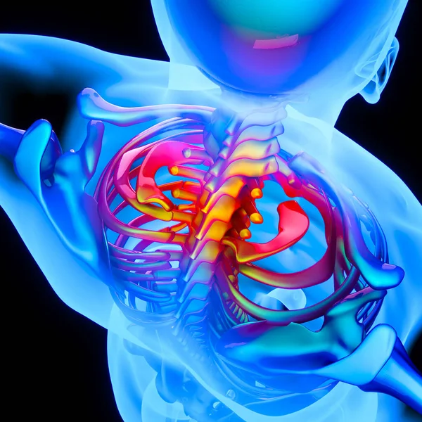 脊椎の子宮頸椎への炎症 硬い首 3Dレンダリング — ストック写真