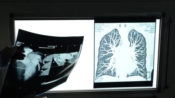 Рентген внутренних органов в клинике — стоковое видео