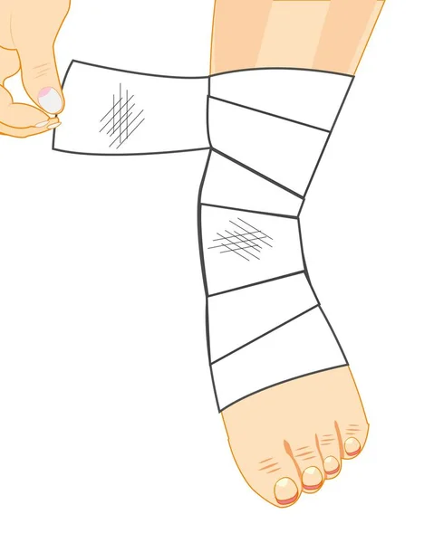 Jambe dans le bandage — Image vectorielle