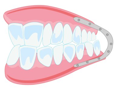 Beyaz arka plan üzerinde takma diş izole edilmiş