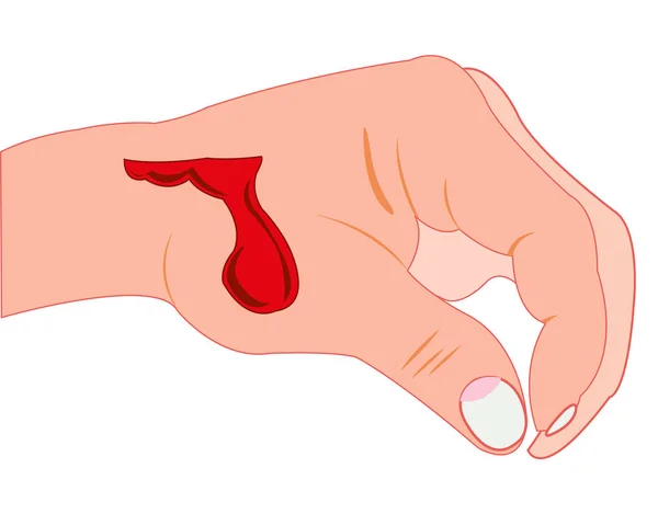 Corte en la mano de la persona y la corriente sanguínea de se apesta — Vector de stock
