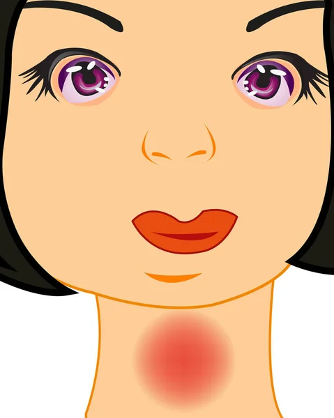 Vector illustration of the girl with pain in throat — Stock Vector