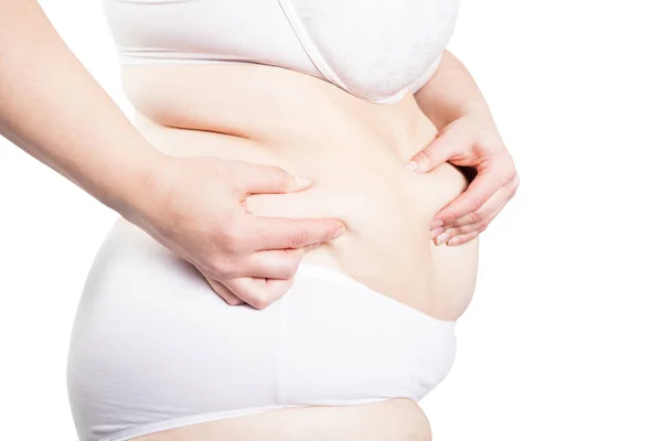 Full Woman Holds Fold Excess Fat Stomach Overweight Obesity Isolated — Stock Photo, Image