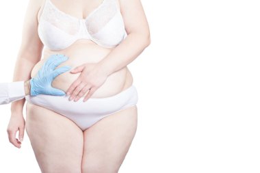 Plastik cerrahi için işaretleme şişman kadının karnında doktor. Kilo kaybı kavramı. (beyaz arka plan üzerinde izole)