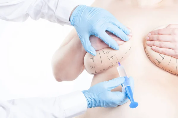 Doktor enjeksiyon ameliyat öncesi (beyaz arka plan üzerinde izole aşırı kilo, obez bir kadın meme içine enjekte eder)