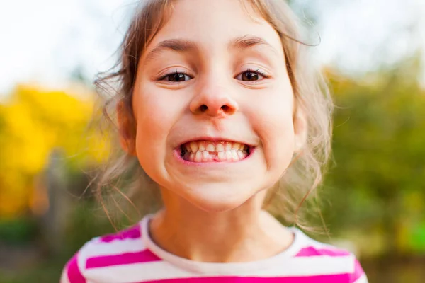 Sonriente chica mostrando el primer diente permanente que viene — Foto de Stock