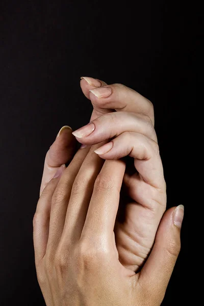 Дві переплетені жіночі руки — стокове фото