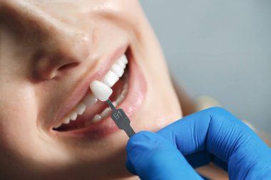 Diş sağlığı kliniği. Resepsiyon, hastanın muayenesi. Diş bakımı. Genç bir kadın diş hekimi tarafından muayene ediliyor. Mutlu hasta ve dişçi konsepti. Diş muayenesinde erkek dişçi kız hastayla konuşuyor. Güzel dişler.